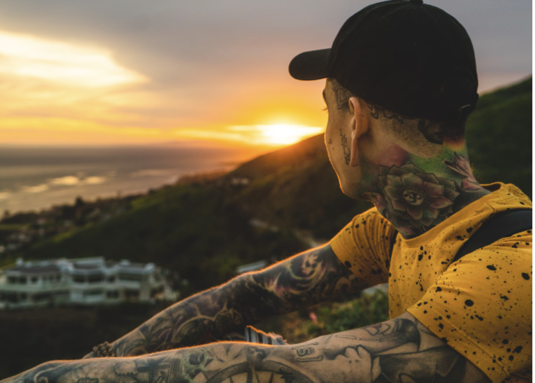 Tattoos with Eczema: Safety Tips and Skin Care Essentials
